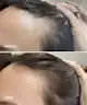UKLASH - Hair Growth Serum