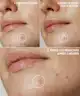 By BEAUTY BAY - Hydrocolloid Spot Patches - 144pcs