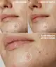By BEAUTY BAY - Hydrocolloid Spot Patches - 144pcs