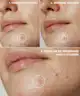 By BEAUTY BAY - Hydrocolloid Spot Patches - 144pcs