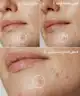 By BEAUTY BAY - Hydrocolloid Spot Patches - 144pcs
