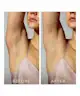 Foreo - Peach 2.0 IPL Hair Removal Device