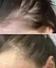 UKLASH - Hair Growth Serum
