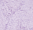 SUVA0020F