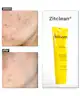 Acnemy - Zitclean® Purifying Cleansing Gel