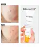 Acnemy - Zitcontrol® Treatment