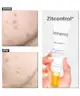 Acnemy - Zitcontrol® Treatment