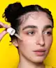 Acnemy - Postzit® Zit Marks Solution