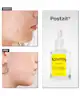 Acnemy - Postzit® Zit Marks Solution