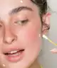 Acnemy - Dryzit® Lotion