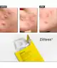 Acnemy - Zitless® Microdart Patches