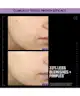 Allies of Skin - Azelaic & Kojic Advanced Clarifying Serum