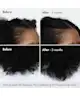 BondiBoost - Procapil Hair Tonic