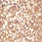 BPER0128F