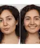 Clinique - Even Better Clinical™ Serum Foundation SPF20
