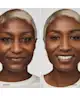 Clinique - Even Better Clinical™ Serum Foundation SPF20