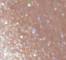 CROP0028F
