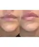 ESHO. - SCULPT Ultra Volumising Lip Serum