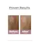 Eucerin - Anti-Pigment Dual Serum