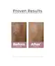 Eucerin - Anti-Pigment Day Cream SPF30
