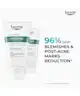 Eucerin - Dermopure Clinical Intense Correcting Cleansing Gel