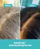 Fable & Mane - SahaScalp™ Amla Soothing Serum