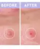 florence by mills - Spot a Spot Blemish Patches