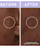 florence by mills - Spot a Spot Blemish Patches