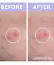 florence by mills - Spot a Spot Blemish Patches