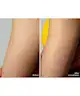 Foreo - PEACH 2 Go IPL Hair Removal Device