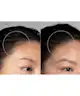 Foreo - LUNA™ 4 Hair
