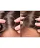 Foreo - FAQ 301 LED Hair Strengthening Scalp Massager