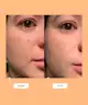 good light cosmetics - Luna Pimple Patch
