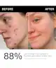 The INKEY List - 15% Vitamin C and EGF Serum
