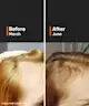 Minimalist - Hair Growth Actives 18% Hair Serum