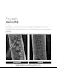 Minimalist - Maleic Bond Repair Complex 5% Hair Serum with Amino acids, Argan oil & Squalane