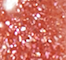 NABL0277F