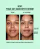 Peace Out - Dark Spots Serum 