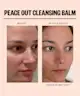 Peace Out - Acne Champions Kit
