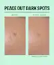 Peace Out - Dark Spots Brightening Dots