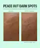 Peace Out - Dark Spots Brightening Dots