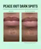 Peace Out - Dark Spots Brightening Dots
