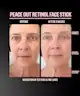 Peace Out - Retinol Face Stick