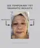 Peter Thomas Roth - Instant FIRMx Eye Temporary Eye Tightener
