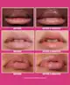 Peter Thomas Roth - Instant FirmX Lip Filler