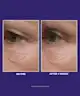 Peter Thomas Roth - Ultimate Solution 5™ Multitasking Eye Cream