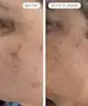 Qure Skincare - Q-Rejuvalight Pro Facewear 
