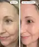 Qure Skincare - Q-Rejuvalight Pro Facewear