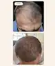 Resèt - Stimulating Scalp Serum
