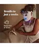 Silk'n - Facial LED Mask 100